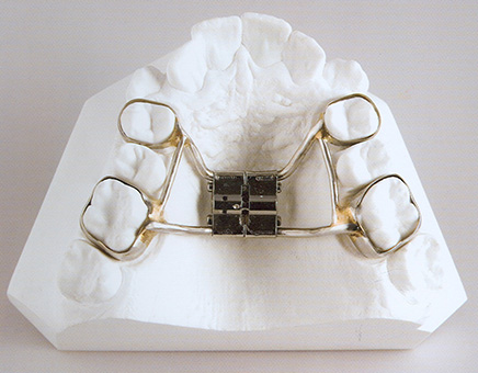 aparate-ortodontice-ortopedice-fixe-cabinet-stoma-targu-mures