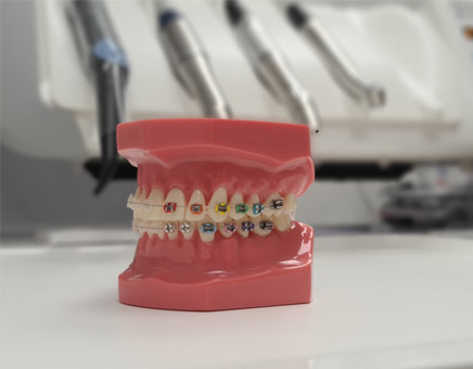 poze-noi_0005_aparat-dentar-metalic-stomatologie-targu-mures